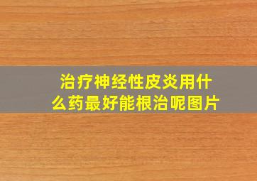 治疗神经性皮炎用什么药最好能根治呢图片