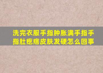 洗完衣服手指肿胀满手指手指肚疙瘩皮肤发硬怎么回事