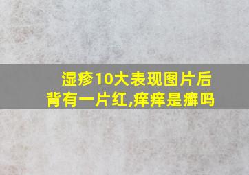 湿疹10大表现图片后背有一片红,痒痒是癣吗