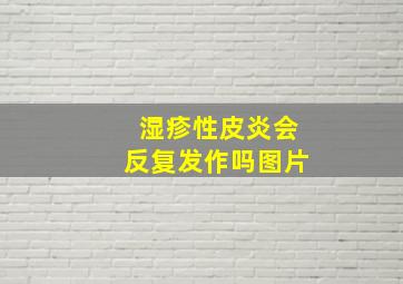 湿疹性皮炎会反复发作吗图片