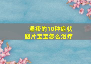 湿疹的10种症状图片宝宝怎么治疗