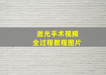 激光手术视频全过程教程图片