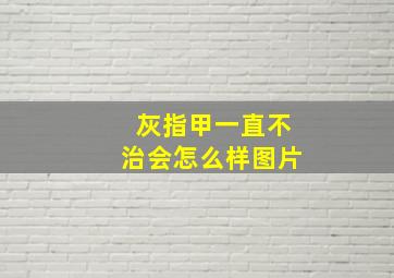 灰指甲一直不治会怎么样图片