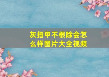 灰指甲不根除会怎么样图片大全视频