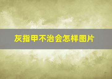 灰指甲不治会怎样图片