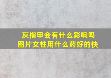 灰指甲会有什么影响吗图片女性用什么药好的快