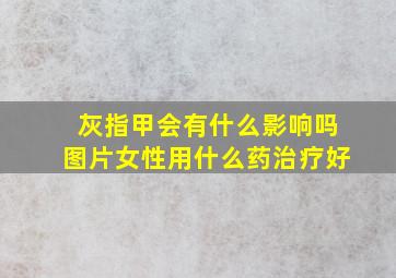 灰指甲会有什么影响吗图片女性用什么药治疗好