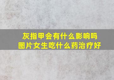 灰指甲会有什么影响吗图片女生吃什么药治疗好