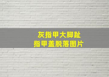 灰指甲大脚趾指甲盖脱落图片