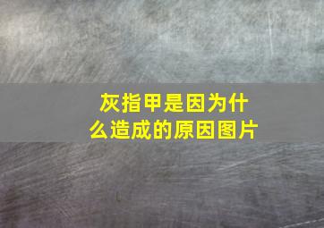 灰指甲是因为什么造成的原因图片