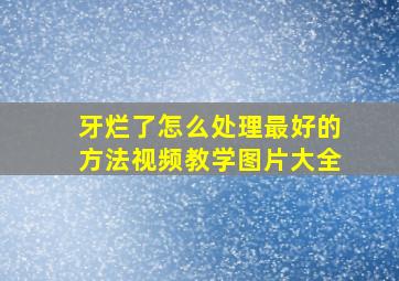 牙烂了怎么处理最好的方法视频教学图片大全