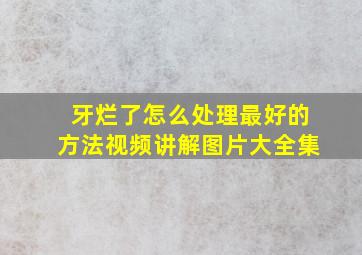 牙烂了怎么处理最好的方法视频讲解图片大全集