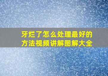 牙烂了怎么处理最好的方法视频讲解图解大全