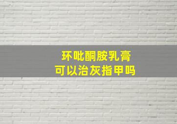 环吡酮胺乳膏可以治灰指甲吗