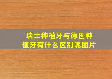 瑞士种植牙与德国种值牙有什么区别呢图片