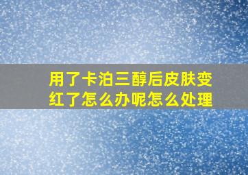 用了卡泊三醇后皮肤变红了怎么办呢怎么处理