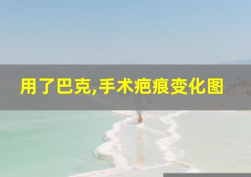 用了巴克,手术疤痕变化图