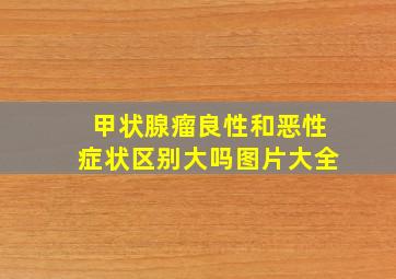 甲状腺瘤良性和恶性症状区别大吗图片大全