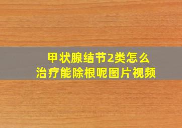 甲状腺结节2类怎么治疗能除根呢图片视频