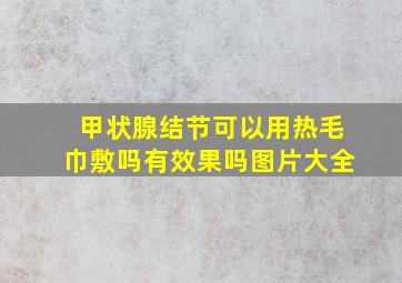 甲状腺结节可以用热毛巾敷吗有效果吗图片大全