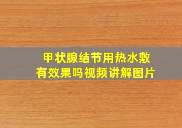 甲状腺结节用热水敷有效果吗视频讲解图片