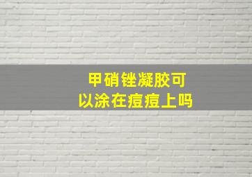 甲硝锉凝胶可以涂在痘痘上吗