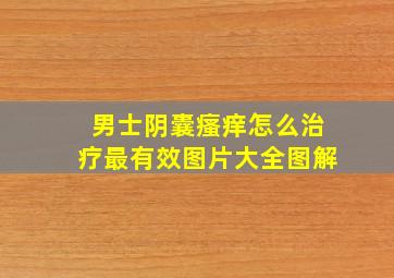 男士阴囊瘙痒怎么治疗最有效图片大全图解