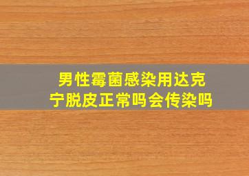 男性霉菌感染用达克宁脱皮正常吗会传染吗