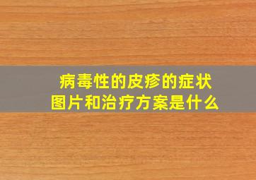 病毒性的皮疹的症状图片和治疗方案是什么