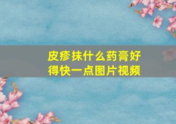 皮疹抹什么药膏好得快一点图片视频