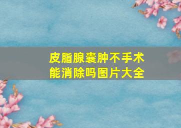 皮脂腺囊肿不手术能消除吗图片大全