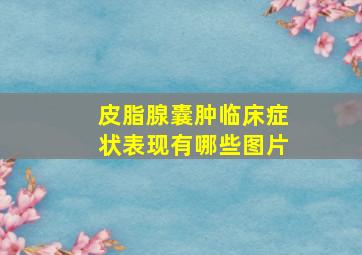 皮脂腺囊肿临床症状表现有哪些图片