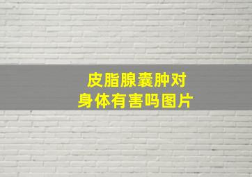 皮脂腺囊肿对身体有害吗图片