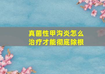 真菌性甲沟炎怎么治疗才能彻底除根