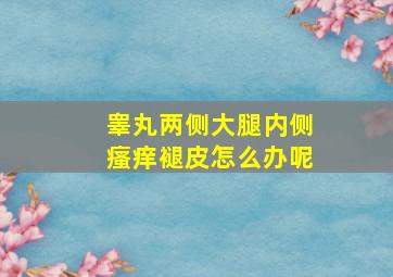 睾丸两侧大腿内侧瘙痒褪皮怎么办呢