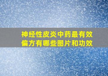 神经性皮炎中药最有效偏方有哪些图片和功效