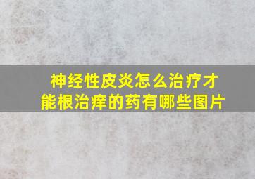 神经性皮炎怎么治疗才能根治痒的药有哪些图片