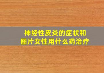 神经性皮炎的症状和图片女性用什么药治疗