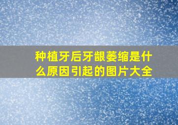 种植牙后牙龈萎缩是什么原因引起的图片大全