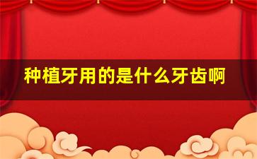 种植牙用的是什么牙齿啊