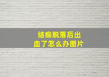 结痂脱落后出血了怎么办图片