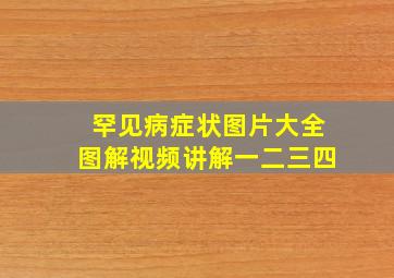 罕见病症状图片大全图解视频讲解一二三四