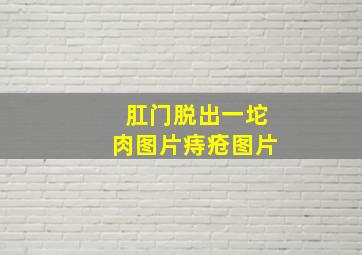 肛门脱出一坨肉图片痔疮图片