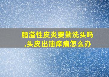 脂溢性皮炎要勤洗头吗,头皮出油痒痛怎么办