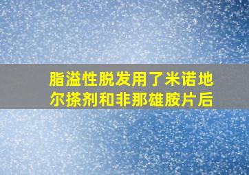 脂溢性脱发用了米诺地尔搽剂和非那雄胺片后