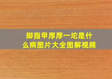 脚指甲厚厚一坨是什么病图片大全图解视频