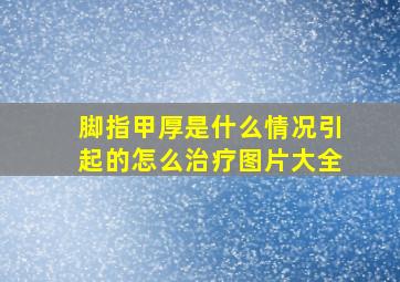 脚指甲厚是什么情况引起的怎么治疗图片大全