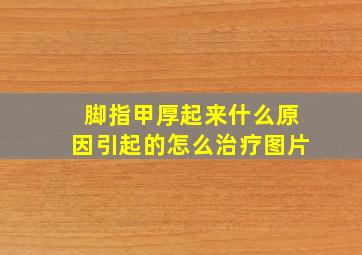 脚指甲厚起来什么原因引起的怎么治疗图片