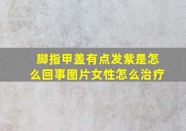 脚指甲盖有点发紫是怎么回事图片女性怎么治疗