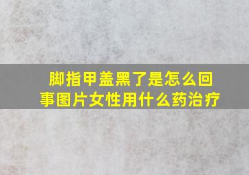 脚指甲盖黑了是怎么回事图片女性用什么药治疗